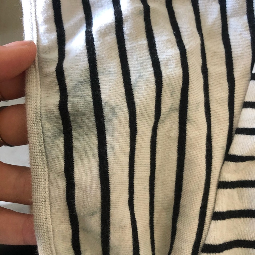 Maison Margiela cut out striped dress - Picture 5 of 7